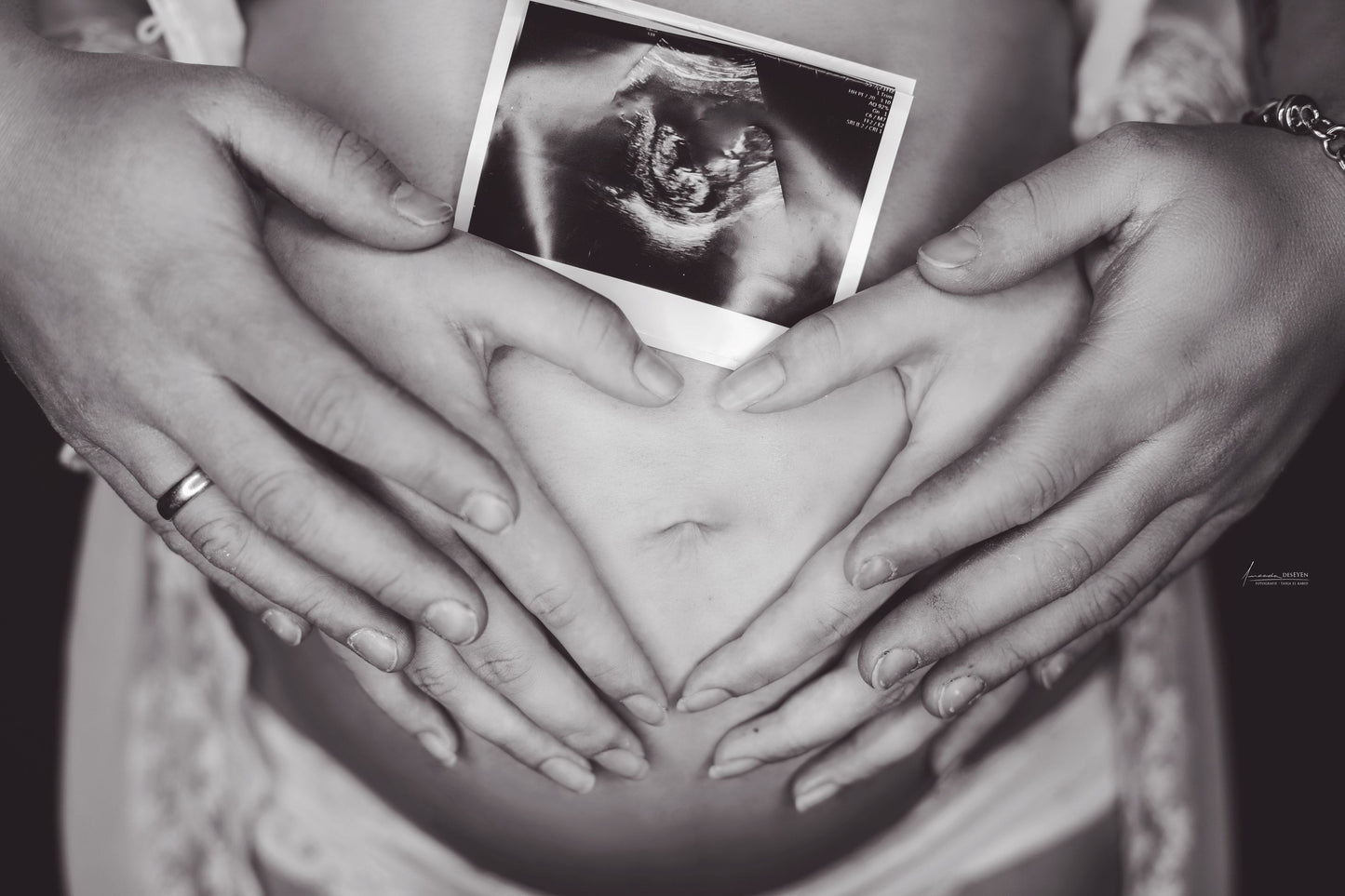 Babybauch